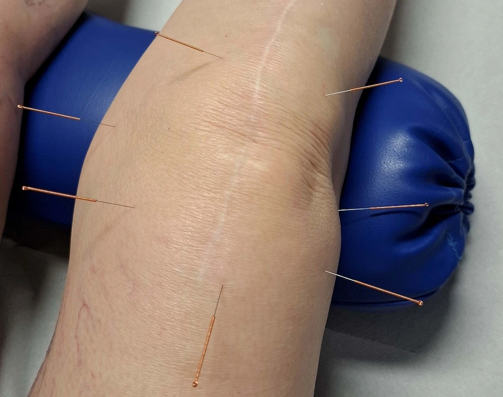 manuelle Therapie in der Praxis von Heilpraktiker Jianhua Wang in Dortmund